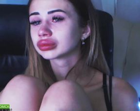 Violla cries in botox